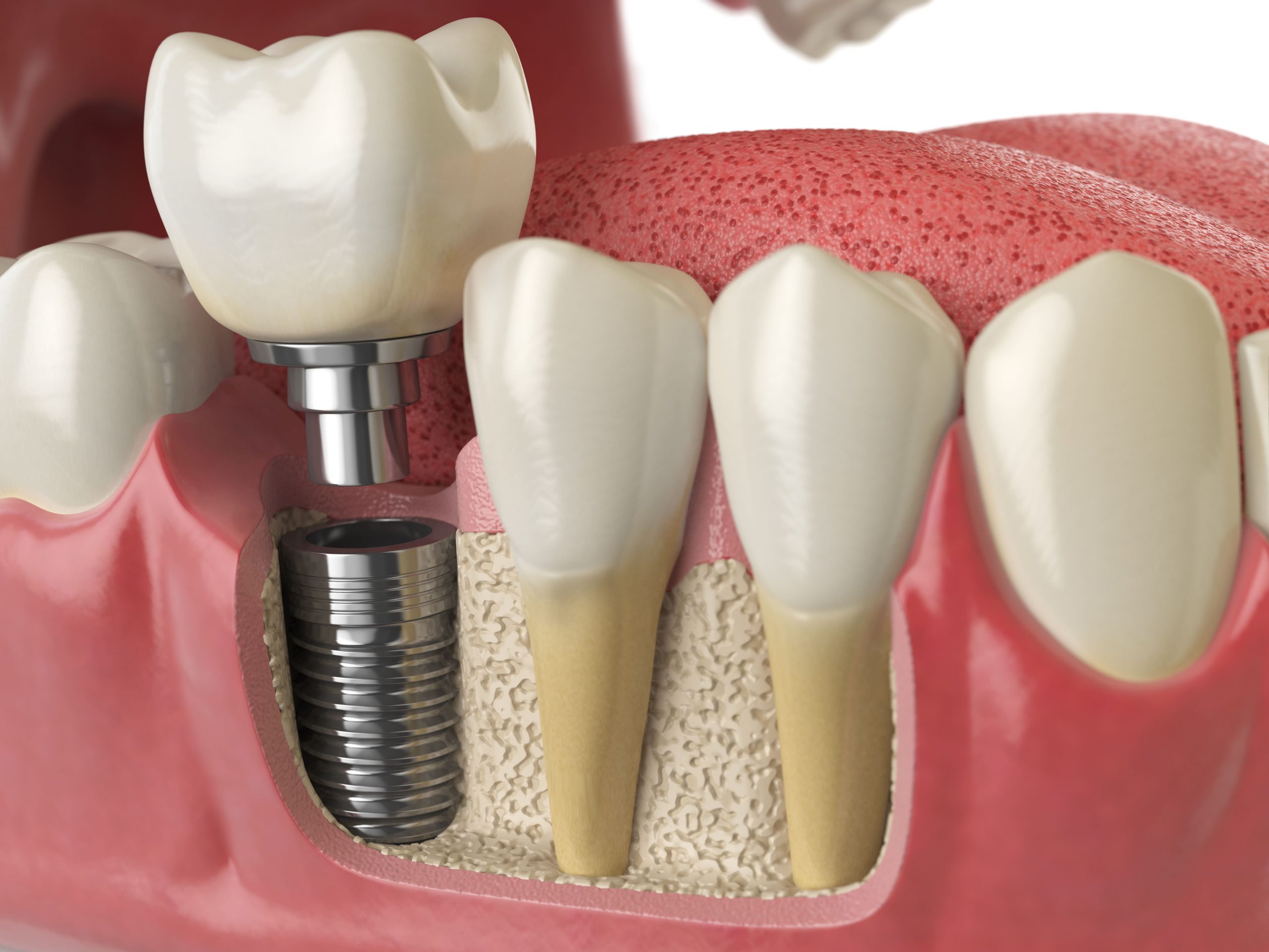 anatomy-of-healthy-teeth-and-tooth-dental-implant-2021-08-26-16-56-57-utc (1)