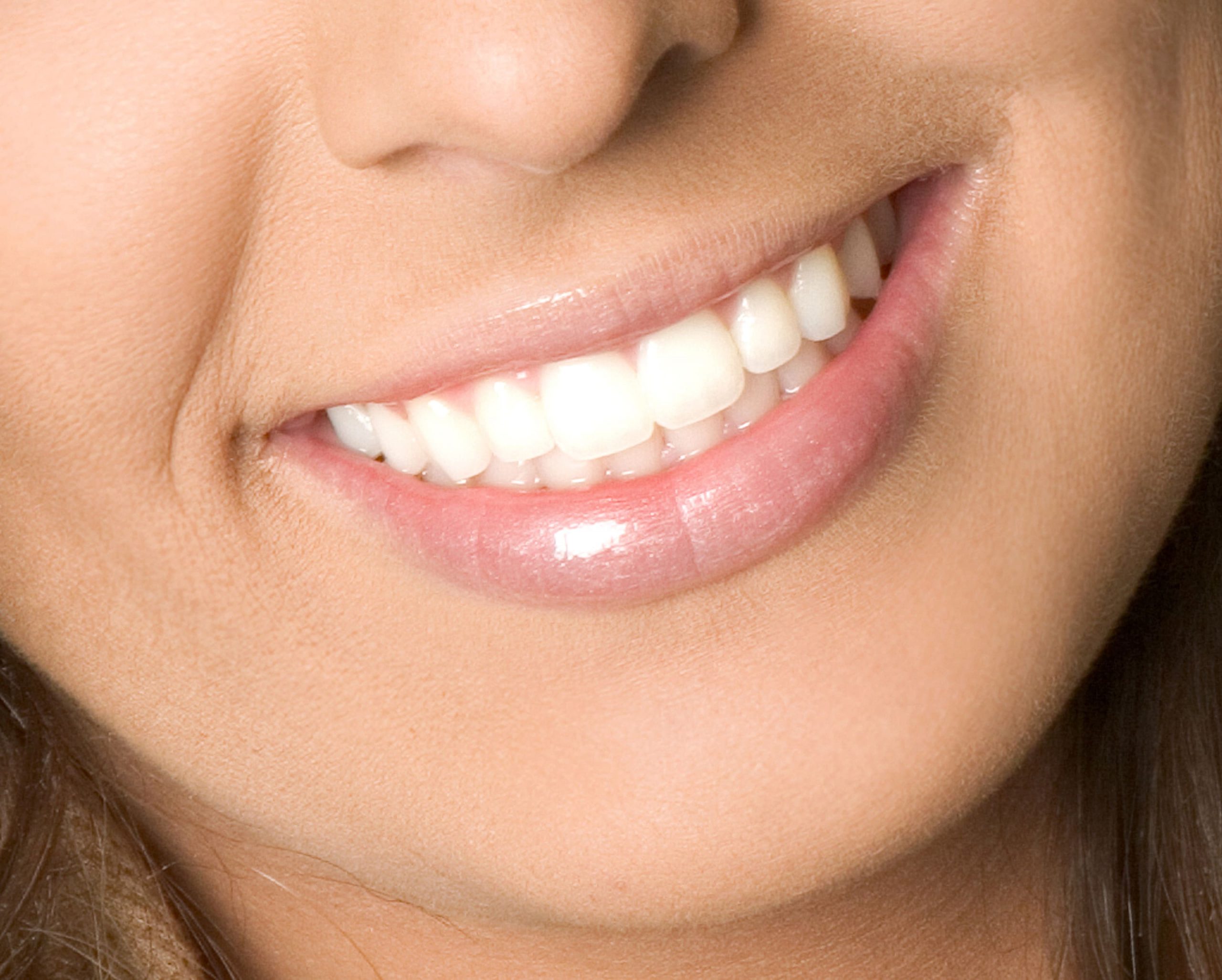 healthy-woman-teeth-and-smile-2022-11-22-16-23-29-utc (1)